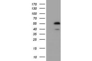 Western Blotting (WB) image for anti-Epoxide Hydrolase 2, Cytoplasmic (EPHX2) antibody (ABIN1500857) (EPHX2 anticorps)