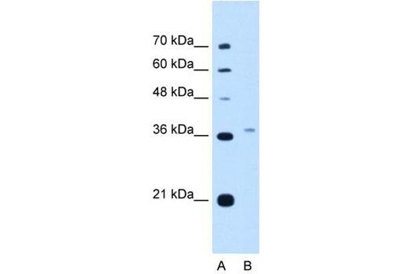 PEX3 anticorps  (N-Term)