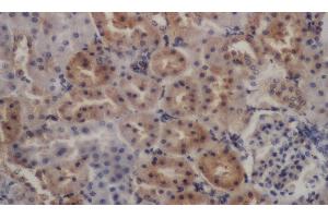 Immunohistochemistry of paraffin-embedded Rat kidney using PDGFRB Polyclonal Antibody at dilution of 1:50 (PDGFRB anticorps)