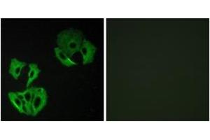 Immunofluorescence (IF) image for anti-MAP-Kinase Activating Death Domain (MADD) (AA 751-800) antibody (ABIN2889697) (MADD anticorps  (AA 751-800))