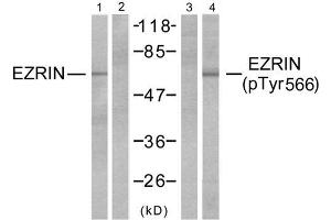 Western blot analysis of extracts from A431 cells, untreated or EGF-treated (200ng/ml, 30min) using Ezrin (Ab-566) antibody (E021200, Lane 1 and 2) and Ezrin (phospho-Thr566) antibody (E011202, Lane 3 and 4). (Ezrin anticorps)