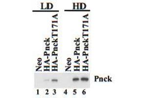 Neo, HA-Pnck and HA-Pnck T171A HEK-293 cells were plated at low (LD) and high (HD) cell density and lysates prepared after 48 hours. (PNCK anticorps  (C-Term))