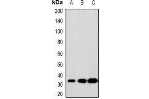 Western blot analysis of SCP3 expression in K562 (A), 22RV1 (B), H480 (C) whole cell lysates. (SYCP3 anticorps)