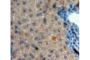 Used in DAB staining on fromalin fixed paraffin-embedded Liver tissue (CRH anticorps  (AA 40-195))