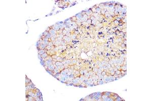 Immunohistochemistry of paraffin-embedded mouse testis using Integrin alpha 4 (ITG/CD49d) (ITG/CD49d) Rabbit mAb (054) at dilution of 1:100 (40x lens). (ITGA4 anticorps)