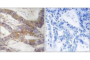 Immunohistochemistry (IHC) image for anti-serpin Peptidase Inhibitor, Clade B (Ovalbumin), Member 9 (SERPINB9) (AA 241-290) antibody (ABIN2890628) (SERPINB9 anticorps  (AA 241-290))