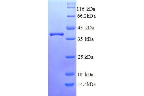 RNF7 Protein (AA 2-113) (GST tag)