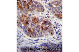 Immunohistochemistry (IHC) image for anti-HCLS1 Associated Protein X-1 (HAX1) antibody (ABIN2996652) (HAX1 anticorps)