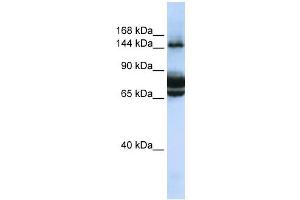 FAM83B antibody used at 1 ug/ml to detect target protein. (FAM83B anticorps  (C-Term))