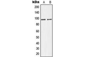 Western blot analysis of GIT1 expression in HuvEc (A), HeLa (B) whole cell lysates. (GIT1 anticorps  (C-Term))