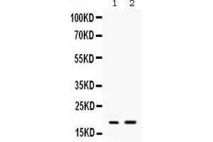 Western blot analysis of Peptide YY expression in mouse spleen extract ( Lane 1) and mouse liver extract ( Lane 2). (Peptide YY anticorps  (Middle Region))