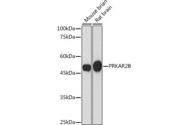 PRKAR2B anticorps