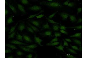 Immunofluorescence of monoclonal antibody to SMAD7 on HeLa cell. (SMAD7 anticorps  (AA 160-260))