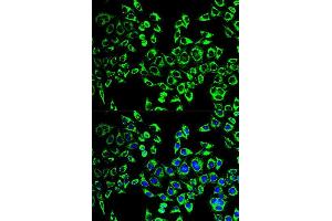 Immunofluorescence analysis of HeLa cell using HSPD1 antibody. (HSPD1 anticorps  (AA 27-240))