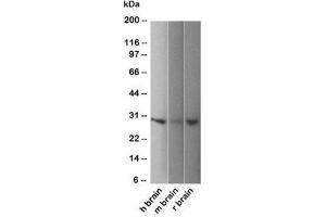 Western blot of human, mouse and rat brain lysate using PGP9. (UCHL1 anticorps)