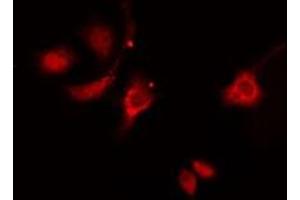 ABIN6276317 staining  HeLa cells by IF/ICC. (HSP27 anticorps  (N-Term))