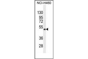 Western blot analysis of FNDC8 Antibody (Center) in NCI-H460 cell line lysates (35ug/lane). (FNDC8 anticorps  (Middle Region))