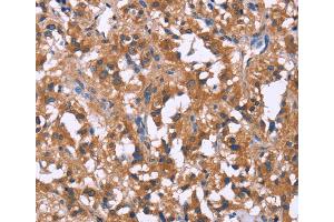 Immunohistochemistry (IHC) image for anti-G Protein-Coupled Receptor 172B (GPR172B) antibody (ABIN2433107) (GPR172B anticorps)