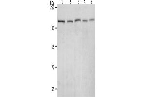 Western Blotting (WB) image for anti-RAD50 Homolog (S. Cerevisiae) (RAD50) antibody (ABIN2426375) (RAD50 anticorps)