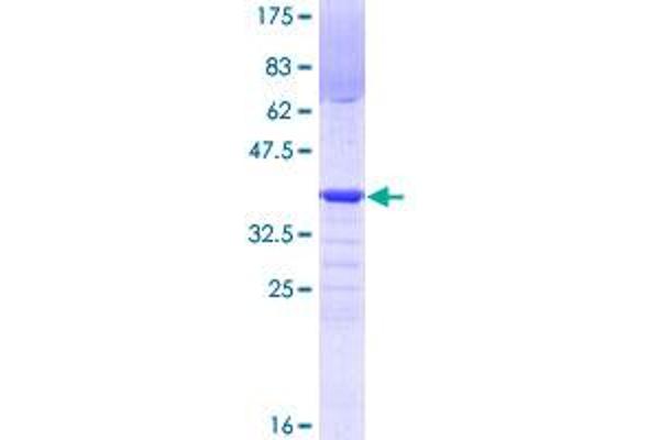 PRDM4 Protein (AA 476-575) (GST tag)