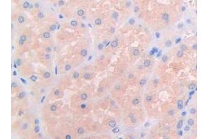 IHC-P analysis of Human Kidney Tissue, with DAB staining. (IL3RA anticorps  (AA 19-157))