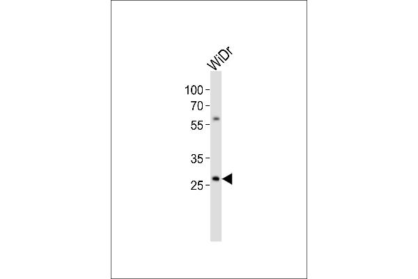 COX11 anticorps  (C-Term)