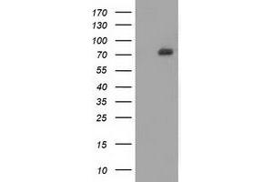 HEK293T cells were transfected with the pCMV6-ENTRY control (Left lane) or pCMV6-ENTRY SAMHD1 (Right lane) cDNA for 48 hrs and lysed. (SAMHD1 anticorps)