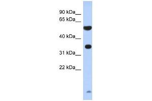 ESSPL antibody used at 1 ug/ml to detect target protein. (ESSPL anticorps  (N-Term))