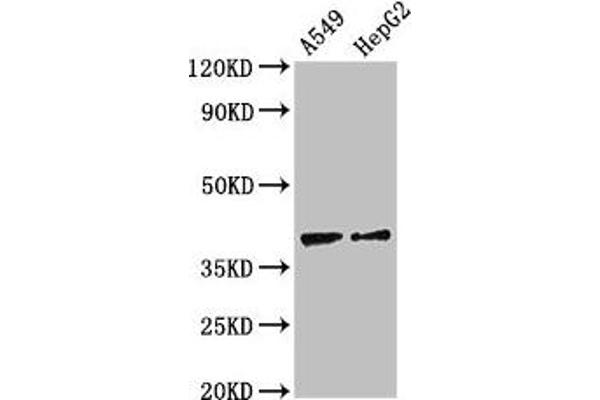 CCR1 anticorps  (AA 314-362)