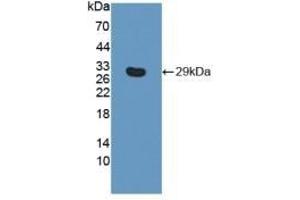 Detection of Recombinant ITGb6, Human using Polyclonal Antibody to Integrin Beta 6 (ITGb6) (ITGB6 anticorps  (AA 131-371))