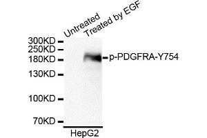 Western blot analysis of extracts of HepG2 cell line, using Phospho-PDGFRA-Y754 antibody. (PDGFRA anticorps  (pTyr754))