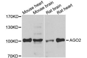 Western blot analysis of extracts of various cell lines, using AGO2 antibody (ABIN1877052) at 1:1000 dilution. (AGO2 anticorps)