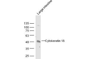 Western Blotting (WB) image for anti-Keratin 18 (KRT18) (AA 53-150) antibody (ABIN676973)