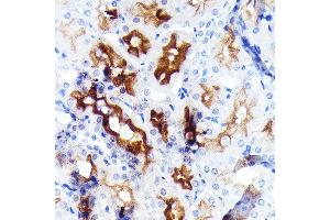 Immunohistochemistry of paraffin-embedded rat kidney using P Glycoprotein Rabbit mAb (ABIN7265732) at dilution of 1:100 (40x lens). (ABCB1 anticorps)