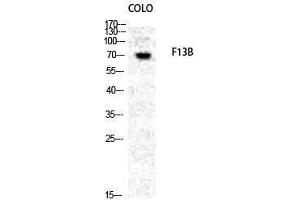 Western Blotting (WB) image for anti-Coagulation Factor 13, B Polypeptide (F13B) (N-Term) antibody (ABIN3175044) (F13B anticorps  (N-Term))