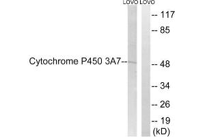Western blot analysis of extracts from LOVO cells, using CYP3A7 antibody. (CYP3A7 anticorps  (Internal Region))
