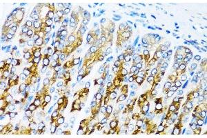 Immunohistochemistry of paraffin-embedded Mouse stomach using ACVR1C Polyclonal Antibody at dilution of 1:100 (40x lens). (ACVR1C/ALK7 anticorps)