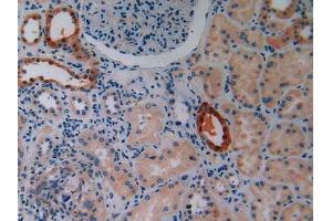 IHC-P analysis of Human Kidney Tissue, with DAB staining. (IGF2R anticorps  (AA 2167-2442))