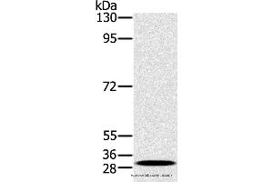 Western blot analysis of K562 cell, using RAB27A Polyclonal Antibody at dilution of 1:400 (RAB27A anticorps)