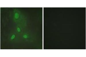 Immunofluorescence (IF) image for anti-BTB and CNC Homology 1, Basic Leucine Zipper Transcription Factor 1 (BACH1) (AA 131-180) antibody (ABIN2889311) (BACH1 anticorps  (AA 131-180))