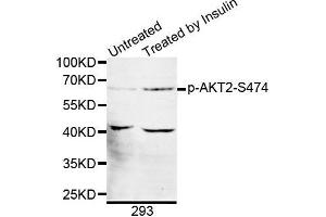 Western blot analysis of extracts of 293 cell line, using phospho-AKT2-S474 antibody. (AKT2 anticorps  (pSer474))