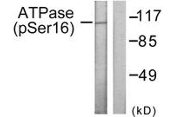 ATPase anticorps  (pSer16)