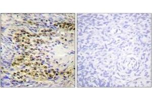 Immunohistochemistry analysis of paraffin-embedded human ovary, using Akt (Phospho-Thr72) Antibody. (AKT1 anticorps  (pThr72))