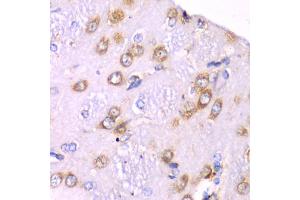 Immunohistochemistry of paraffin-embedded rat brain using RPS3A Antibody. (RPS3A anticorps)