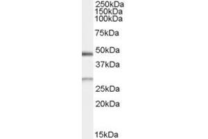 Western Blotting (WB) image for anti-BCL2/adenovirus E1B 19kDa Interacting Protein 1 (BNIP1) antibody (ABIN5858878) (BNIP1 anticorps)