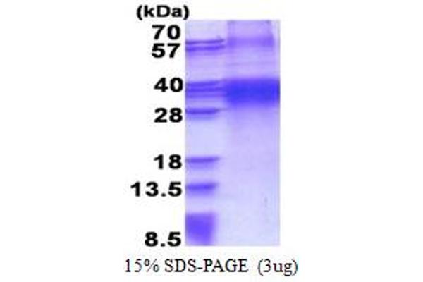 FHL3 Protein (AA 1-280) (His tag)