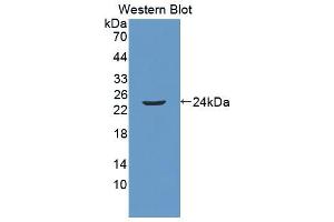 Western blot analysis of the recombinant protein. (Anoctamin 2 anticorps  (AA 823-1003))