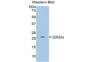 Detection of Recombinant IL1a, Human using Polyclonal Antibody to Interleukin 1 Alpha (IL1a) (IL1A anticorps  (AA 95-269))