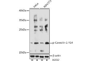 Western blot analysis of extracts of various cell lines, using Phospho-Caveolin-1-Y14 Rabbit pAb (ABIN6135195, ABIN6136032, ABIN6136033 and ABIN6225647) at 1:1000 dilution. (Caveolin-1 anticorps  (pTyr14))