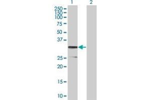 Western Blot analysis of CD79B expression in transfected 293T cell line by CD79B MaxPab polyclonal antibody. (CD79b anticorps  (AA 1-229))